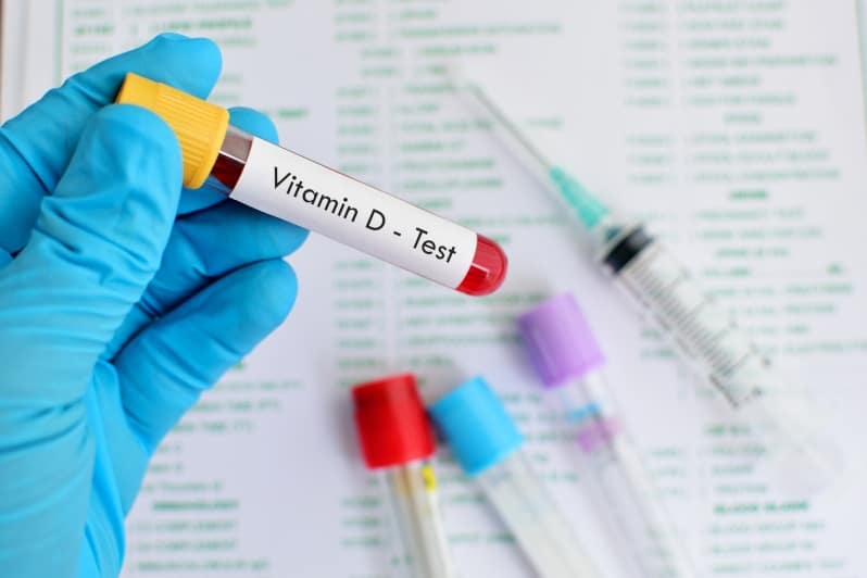 Blood sample for Vitamin D test