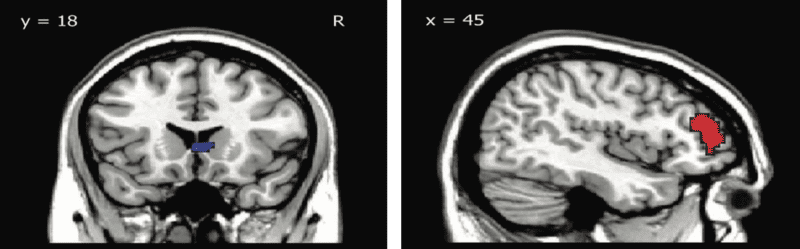 Two fMRI scans of the brain